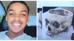 Autopsy photos from the death of Rasheem Carter are shown at a news conference from attorney Ben Crump. (Screenshot from news conference, left. Screenshot from NBC Jackson, Miss. affiliate WLBT, right)