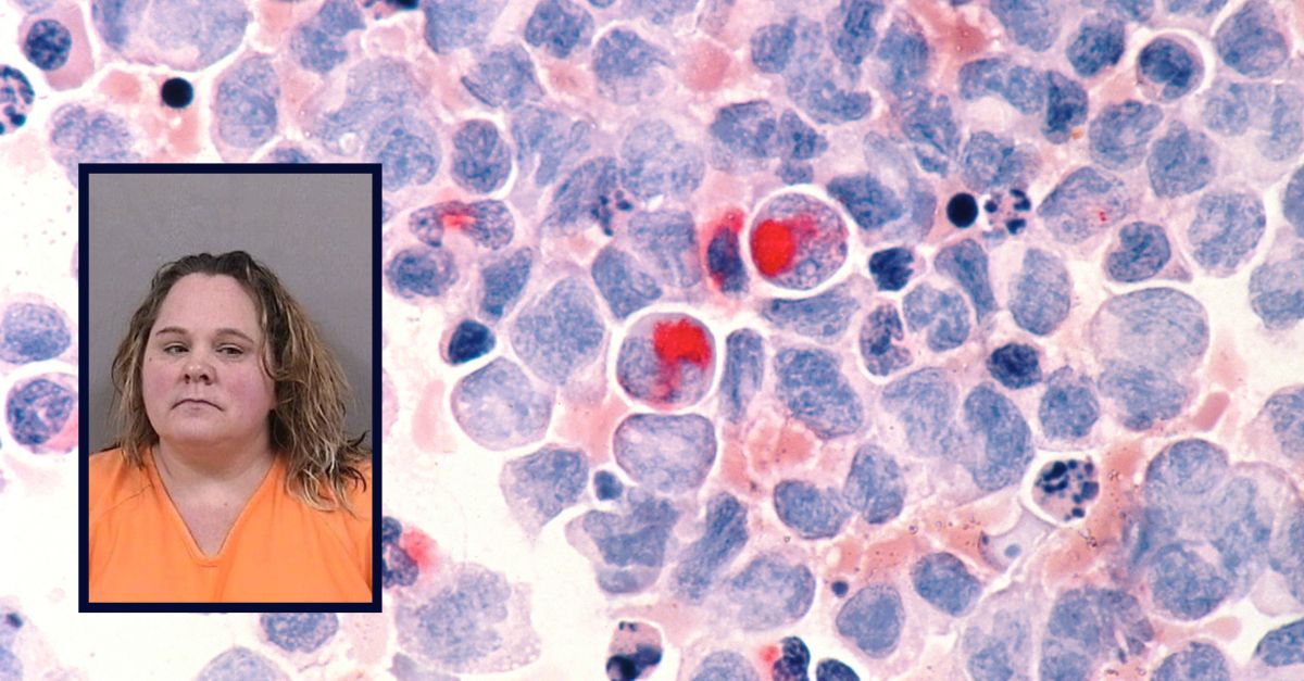 Background: Microscope photo provided by the National Cancer Institute shows human cells with acute myelocytic leukemia. (National Cancer Institute via AP)/Inset: Pamela Reed booking photo Noble County Sheriffs Office
